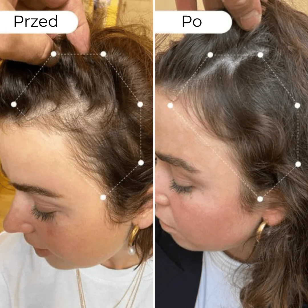 Zdjęcie produktu 3